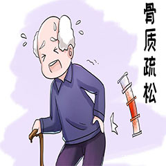骨密度分析儀在檢查骨密度中有什么作用？