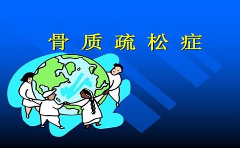 骨密度有哪些種類應如何區(qū)分
