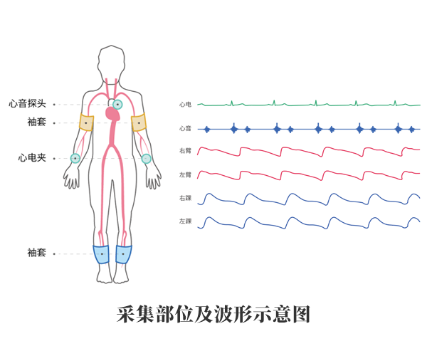 動脈硬化檢測儀產(chǎn)品應(yīng)用